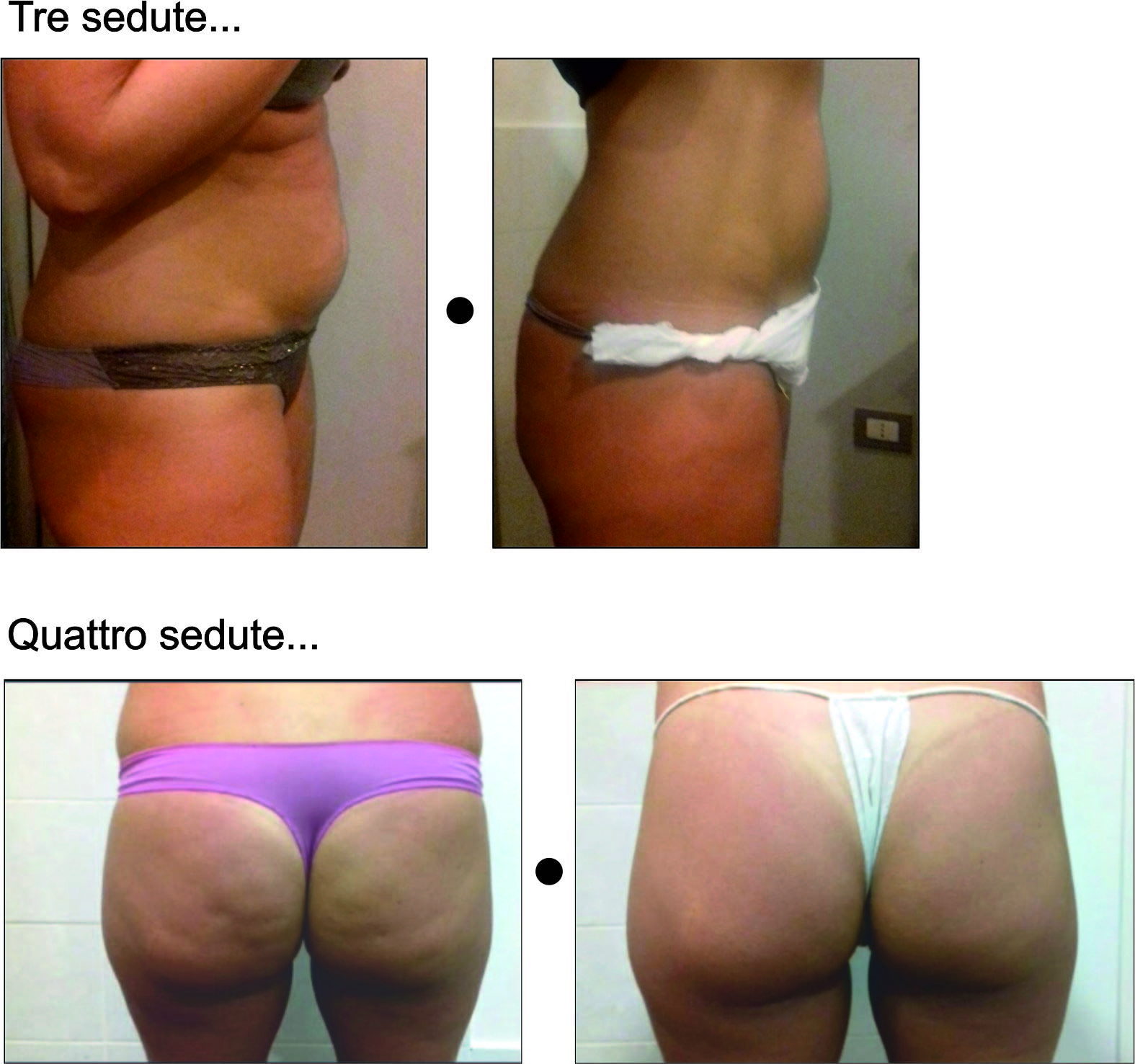 prima e dopo 2 ridotta
