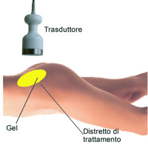 trasduttore